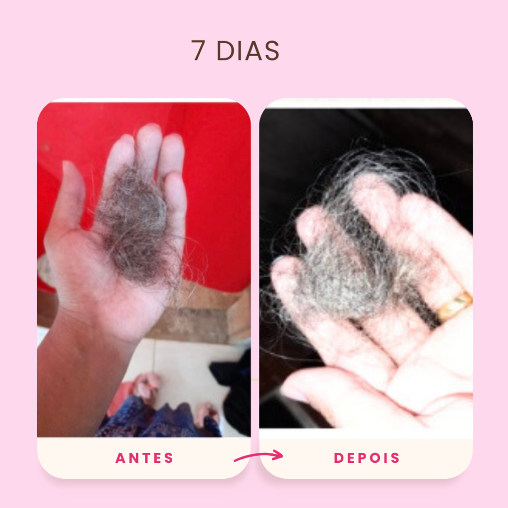 Antes.zip - 7